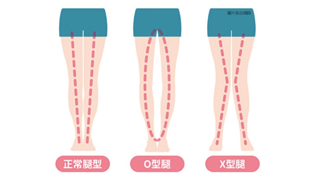 常見腿型