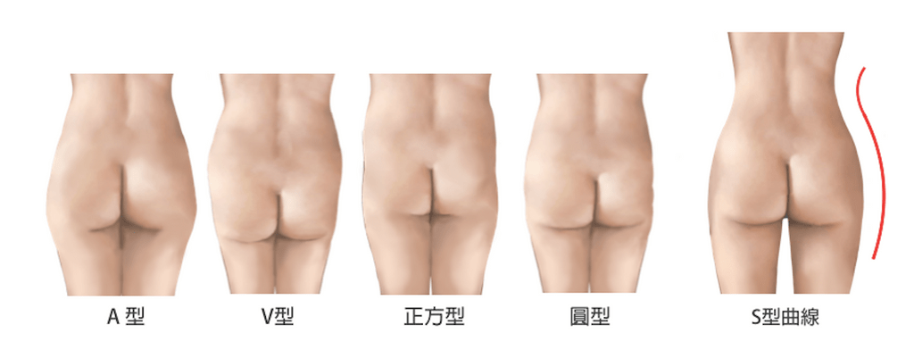 臀部類型