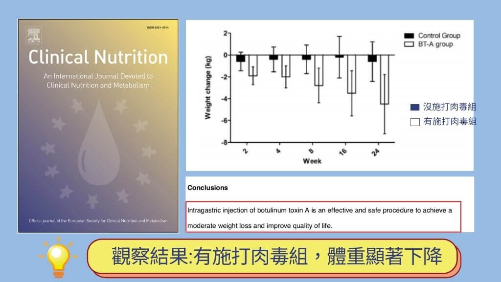 胃肉毒、縮胃針、胃肉毒價格