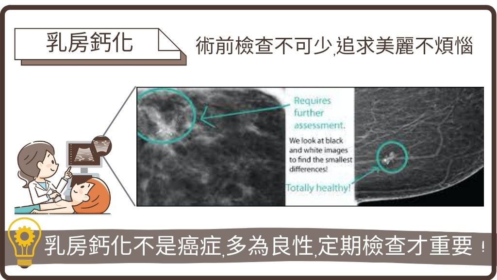 自體脂肪隆乳、豐胸價錢