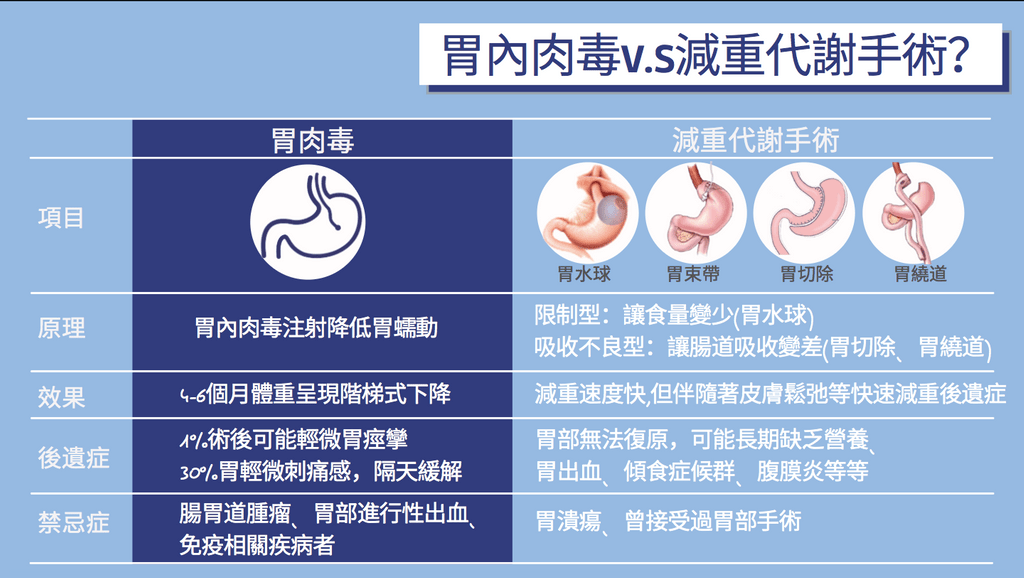 胃肉毒、縮胃針、胃肉毒價格