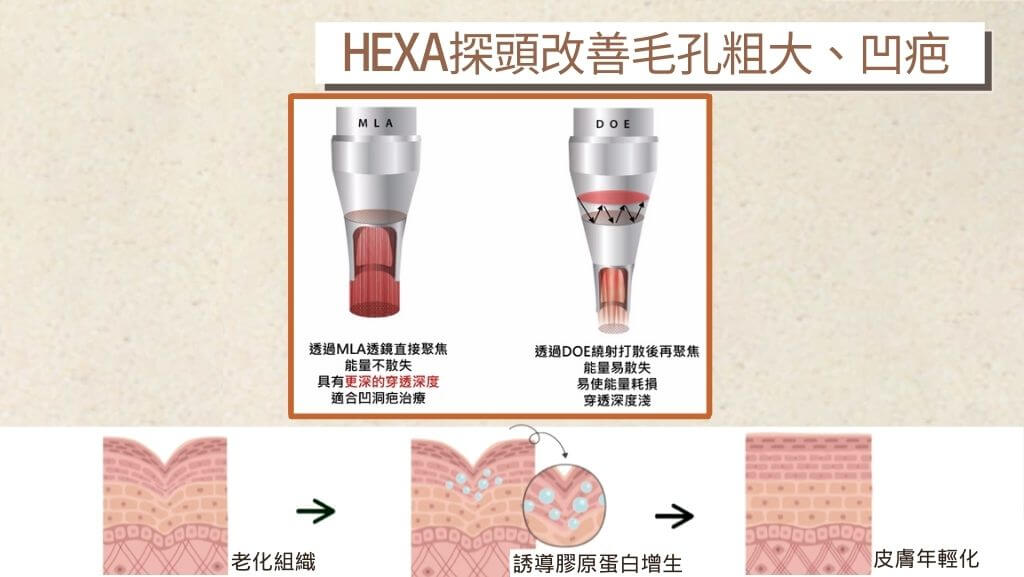 皮秒雷射費用、皮秒雷射失敗、皮秒雷射效果、皮秒雷射術後