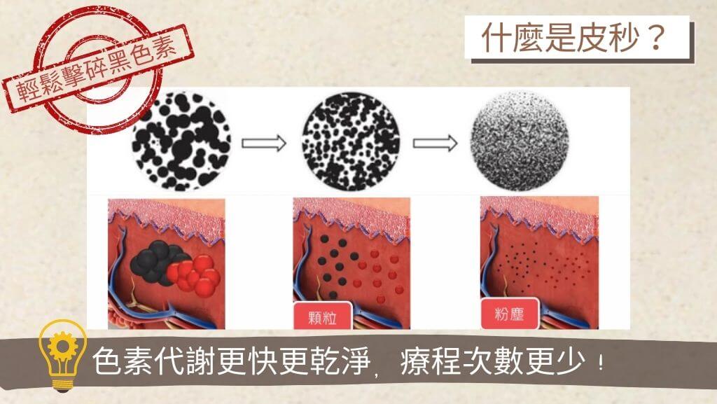 皮秒雷射價格、皮秒雷射是什麼