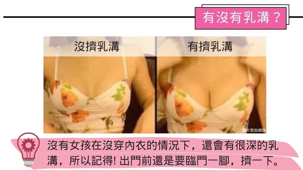 隆乳手術費用、假體隆乳