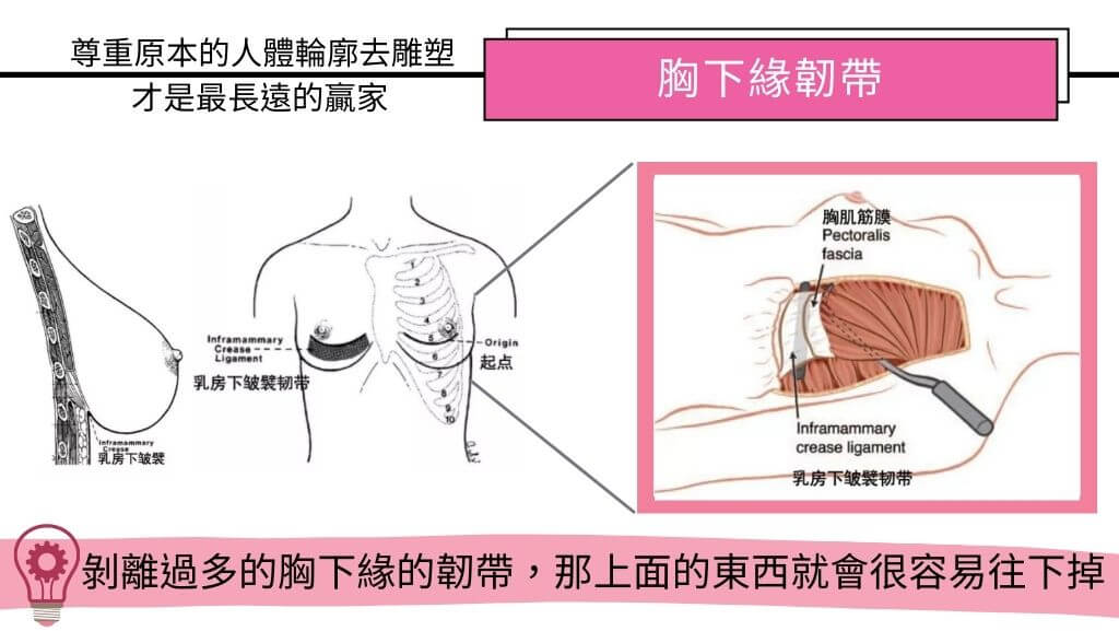 隆乳手術、假體隆乳後遺症、隆乳手術失敗、隆乳費用