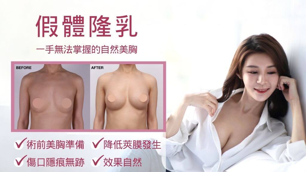 隆乳手術費用、假體隆乳