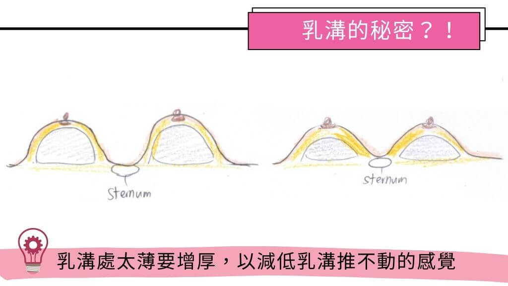 隆乳手術費用、假體隆乳