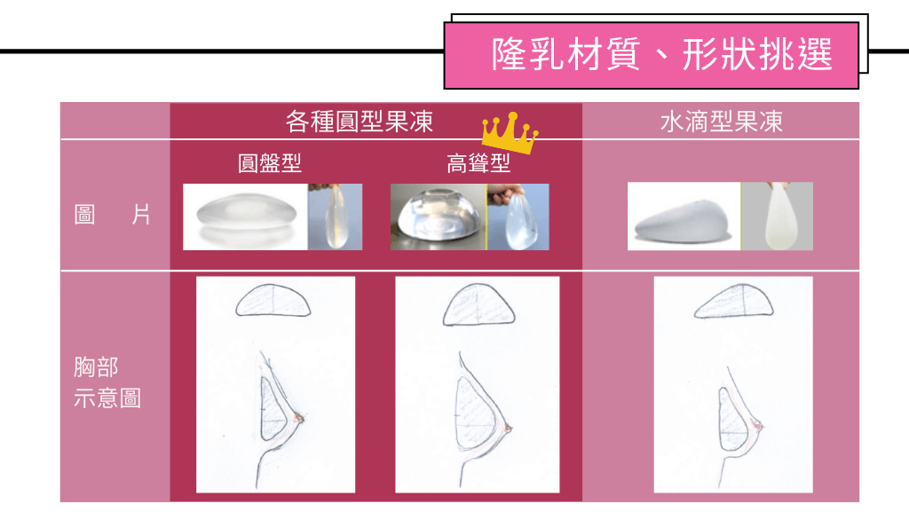 隆乳手術、麗波永康國際診所評價、隆乳手術案例分享