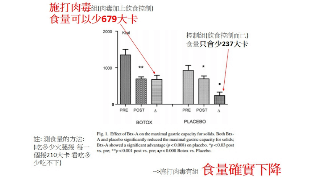 縮胃減重、胃內肉毒、內視鏡減重、麗波永康國際診所胃肉毒