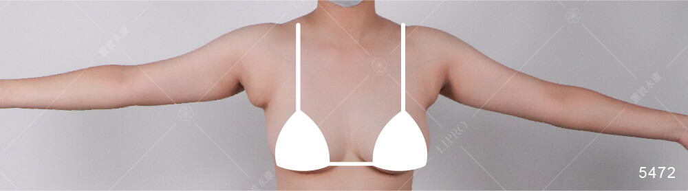 副乳按壓會痛、穿內衣不舒服?紀錄腋下贅肉、副乳抽脂手術前的問題