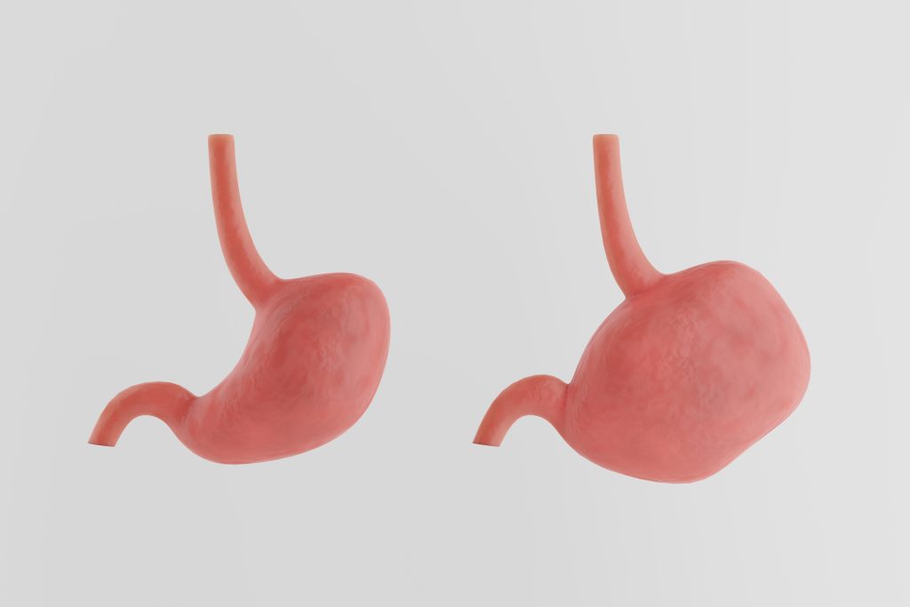 Healthy and sick stomach on a white background. Overeating, bloating concept.